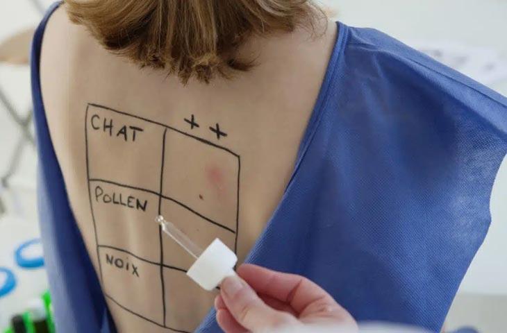 Allergologue